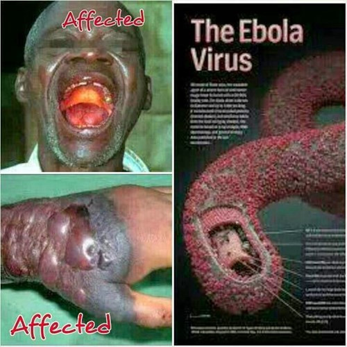 Ảnh 1 của Ebola